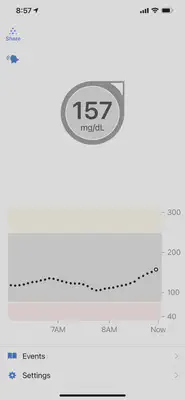 dexcom1