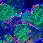 How a T1D cure might happen in my lifetime 🧬